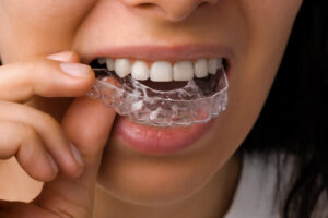 Is Invisalign Painful Here